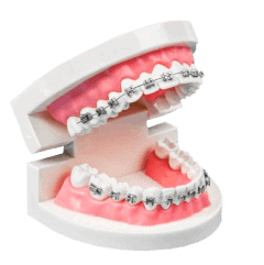 SureSmile Wires